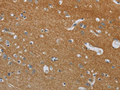 Anti-DPYSL3