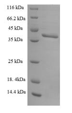 U2 small nuclear ribonucleoprotein B (SNRPB2), human, recombinant