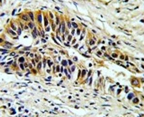 Anti-Transaldolase 1