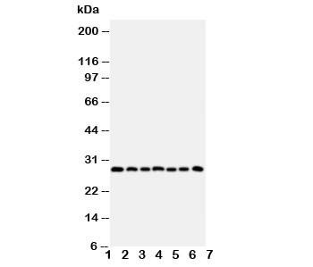 Anti-Kallikrein-11