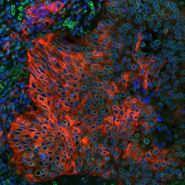 Anti-PD-L1 Recombinant Monoclonal