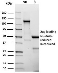 Anti-CD25 / IL2RA, clone IL2RA/4375R
