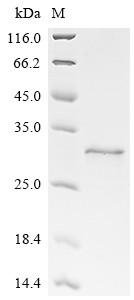 Large T antigen, partial, BK polyomavirus, recombinant