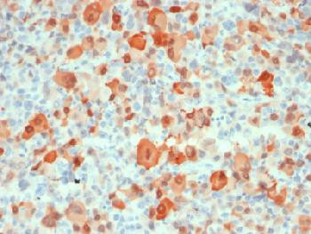 Anti-S100B (Astrocyte and Melanoma Marker) Recombinant Mouse Monoclonal Antibody (clone:rS100B/1012)