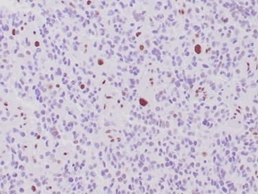 Anti-ATRX / RAD54 (Alpha Thalassemia Mental Retardation), recombinant antibody, clone rATRX/3446