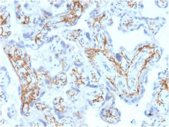 Anti-GSTM1 / Glutathione S-Transferase mu 1, clone CPTC-GSTMu1-3