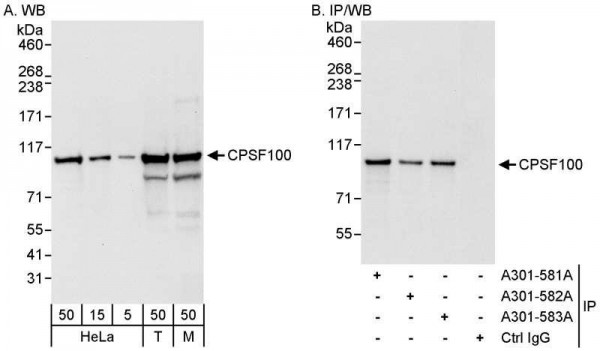 Anti-CPSF100