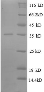 50S ribosomal protein L31 (rpmE), Escherichia coli, recombinant