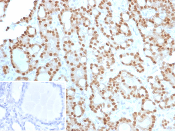 Anti-Cyclin D1 (G1-Cyclin &amp; Mantle Cell Lymphoma Marker), clone CCND1/12039