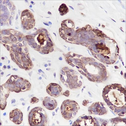 Anti-Recombinant GCDFP-15, clone A228