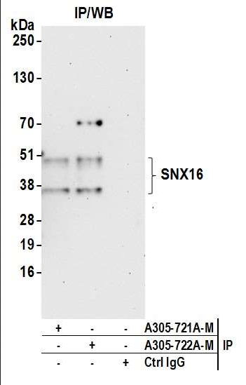 Anti-SNX16