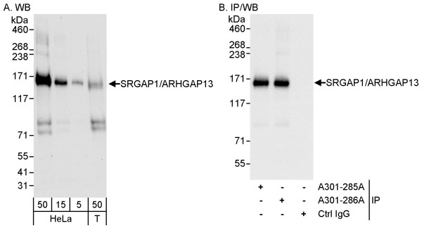 Anti-SRGAP1/ARHGAP13