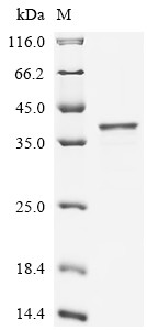 Serine/threonine-protein phosphatase PGAM5,mitochondrial (PGAM5), partial, human, recombinant