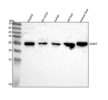 Anti-GAMT / Guanidinoacetate N-methyltransferase