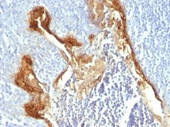 Anti-Involucrin, clone IVRN/827