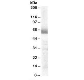 Anti-CYP17A1