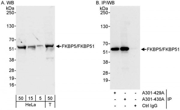 Anti-FKBP5/FKBP51