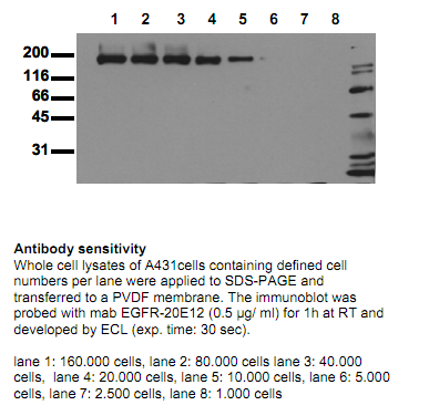 Anti-EGF Receptor (extracellular domain), clone 20E12