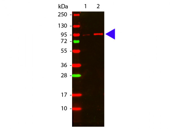 Anti-phospho-AKT (Thr308)