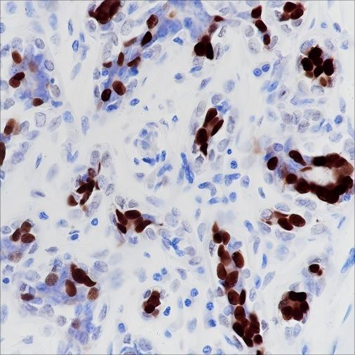 Anti-Recombinant Progesterone Receptor, clone A339