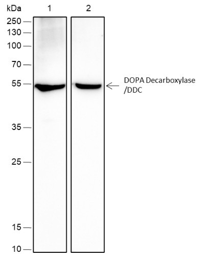 Anti-Recombinant DOPA Decarboxylase/DDC, clone A413