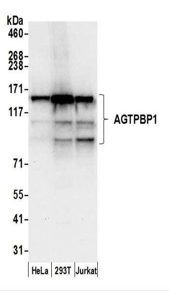 Anti-AGTPBP1