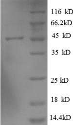 ADP-ribosylation factor-like protein 2-binding protein (ARL2BP), human, recombinant