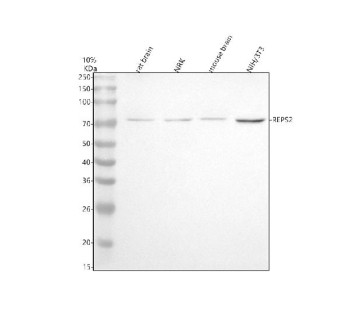 Anti-REPS2 / RalBP1-associated Eps domain-containing protein 2