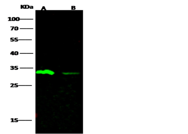 Anti-Carbonic Anhydrase III/CA3 Monoclonal Recombinant Antibody