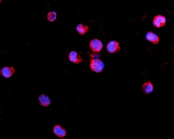 Anti-IL2RG / IL2 Receptor gamma