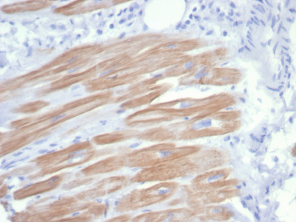 Anti-Sarcomeric Actinin Alpha 2 / ACTN2, recombinant antibody, clone rACTN2/7361