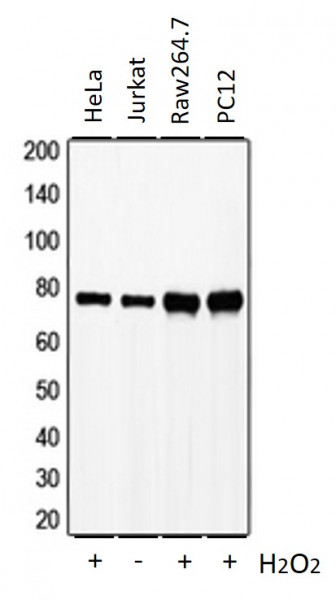 Anti-phospho-LCP2 / SLP76 (Tyr128)