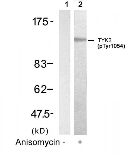 Anti-phospho-TYK2 (Tyr1054)