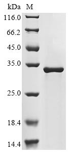 NPC intracellular cholesterol transporter 1 (NPC1), partial, human, recombinant