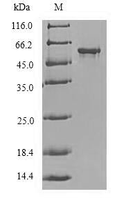 Protein delta homolog 2 (DLK2), partial, human, recombinant
