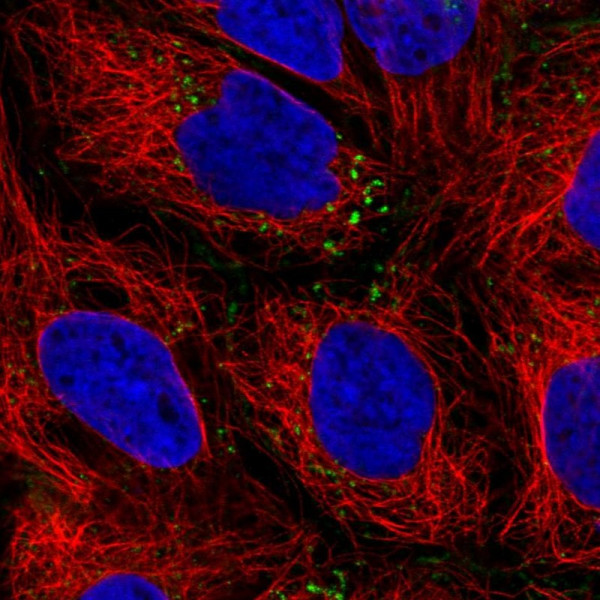 Anti-IQGAP2