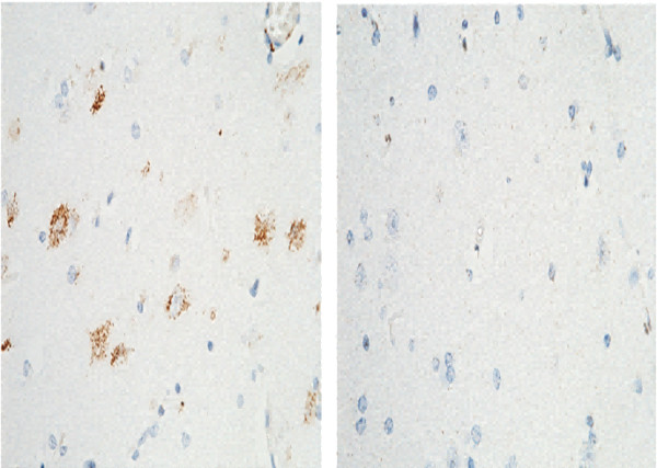 Anti-TrkA/NTRK1 Monoclonal Recombinant Antibody