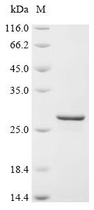 Very-long-chain (3R)-3-hydroxyacyl-CoA dehydratase 3 (HACD3), partial, recombinant human