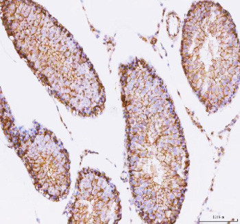 Anti-STK16 / Serine/threonine-protein kinase 16