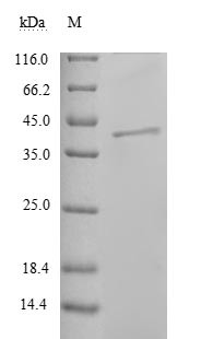 Nucleoprotein (NP), partial, Reston ebolavirus, recombinant