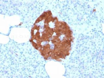 Anti-PGP9.5 / UchL1 (pan-Neuronal Marker) Recombinant Mouse Monoclonal Antibody (clone:rUCHL1/775)