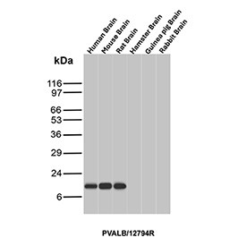 Anti-PVALB / Parvalbumin, clone PVALB/12794R