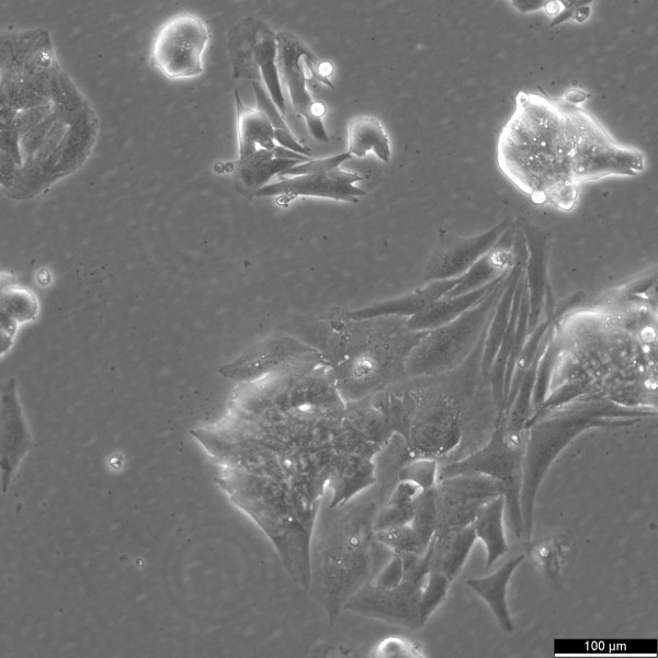 NCI-H2195 Cells