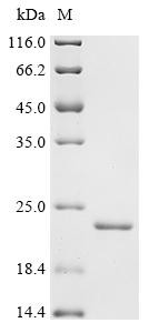 Bromodomain adjacent to zinc finger domain protein 2B (BAZ2B), partial, recombinant human