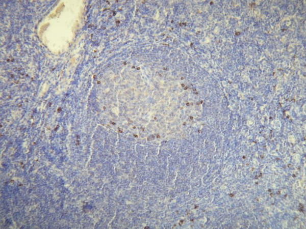 Anti-Human Kappa light chain, clone H16-E