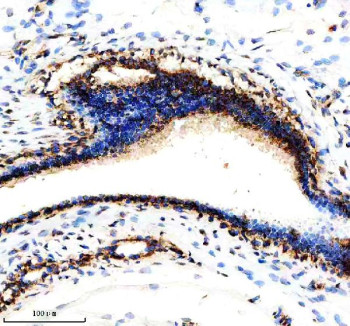 Anti-NDUFS3 / NADH dehydrogenase ubiquinone iron-sulfur protein 3