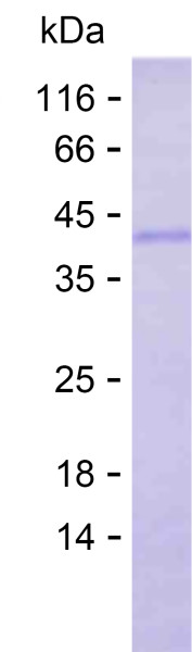 KRT3 (human), recombinant protein