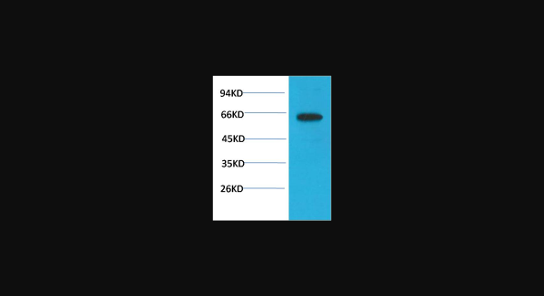 Anti-phospho-Akt (Ser473) (6F8), monoclonal
