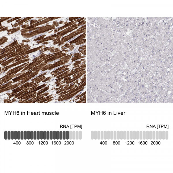 Anti-MYH6, clone CL2155