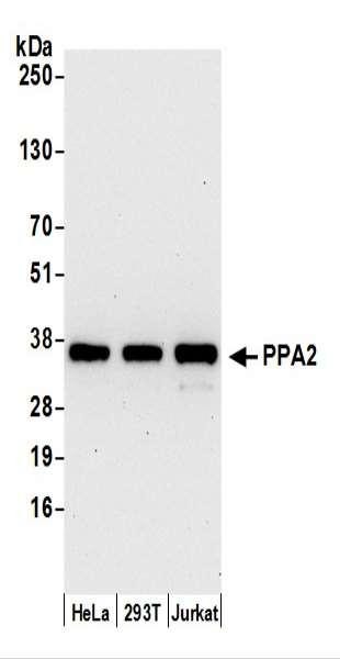 Anti-PPA2